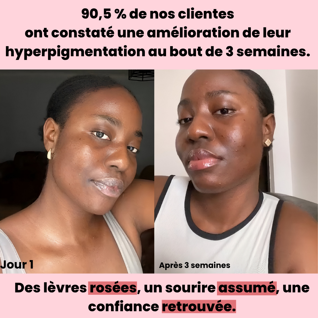 LIP SERUM - JOJOBA OIL. HYALURONIC ACID. VITAMIN E